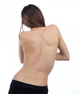 Scoliosis and Chiropractic Care