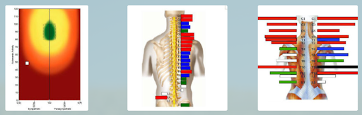 Insight CLA scans for pediatrics