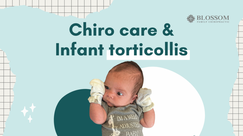treatment for torticollis